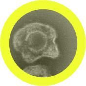 Herpes - Giant Microbe - Brain Spice