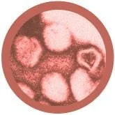 Rubella - Giant Microbe - Brain Spice